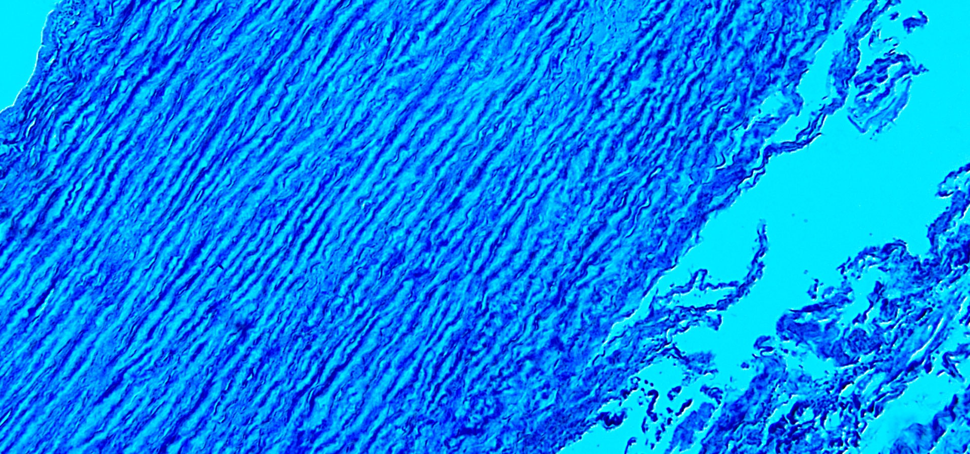 Fisiopatología vascular