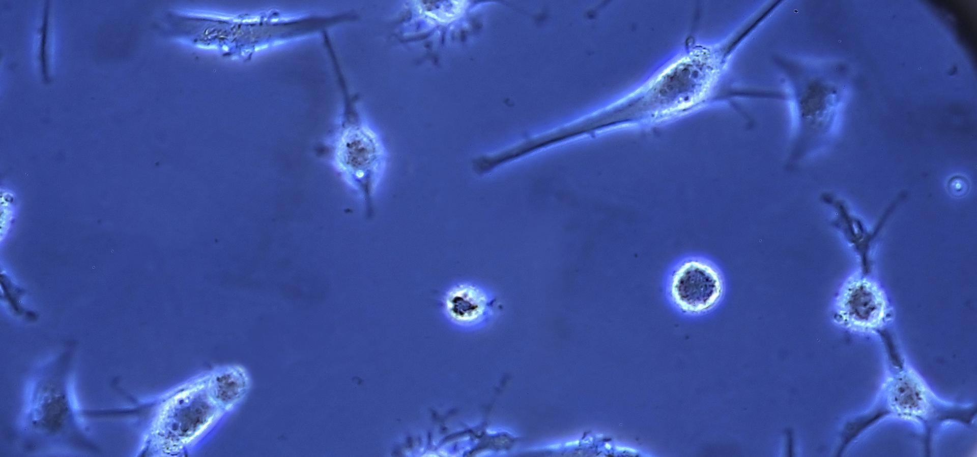 Clinical Neuroproteomics