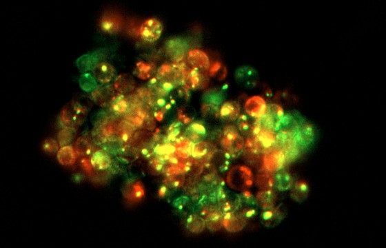 Imagen de microscopía de fluorescencia de linfocitos que expresan constitutivamente la señalización de las moléculas PD-1 (en verde), LAG-3 (en rojo), o ambas (en amarillo).